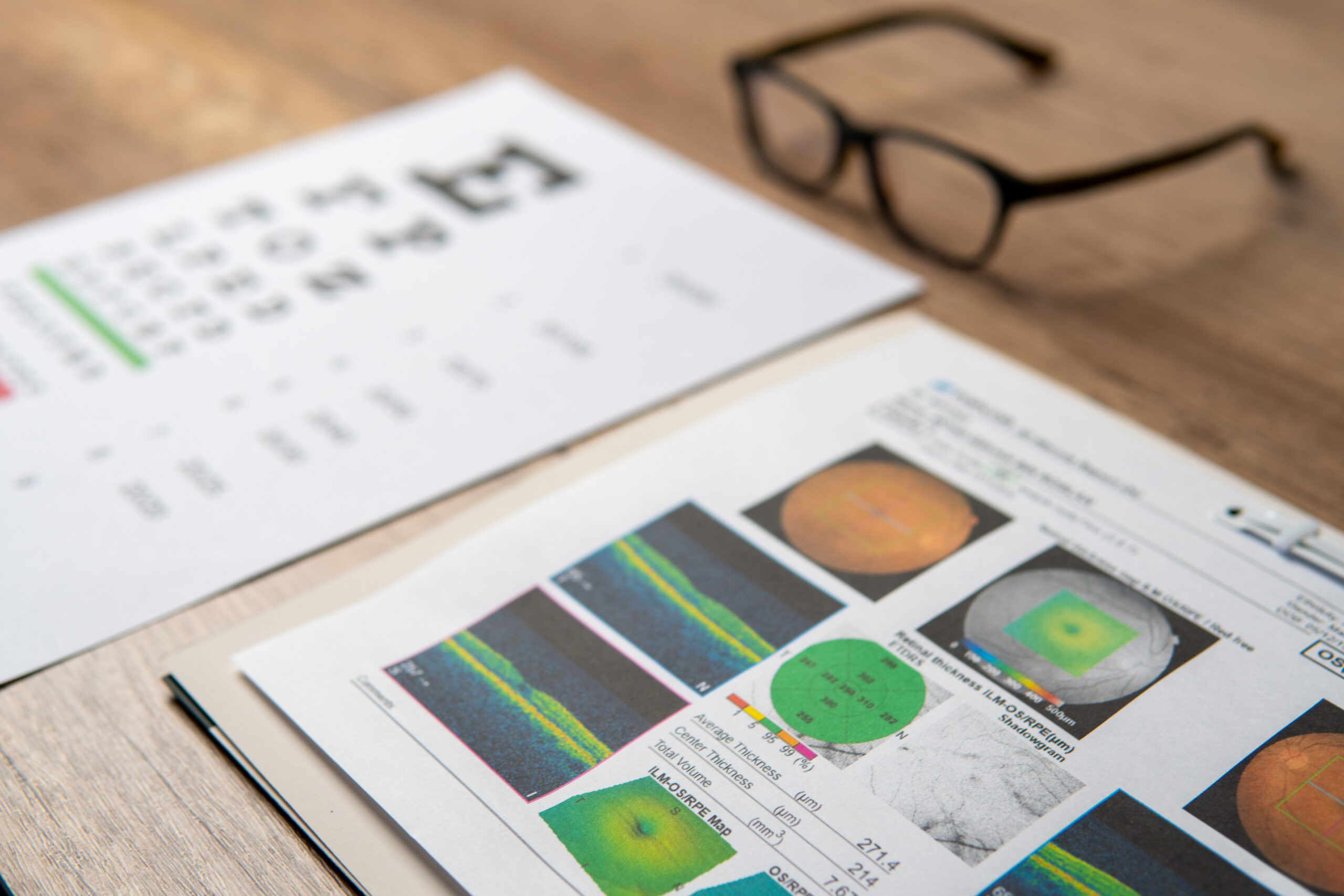 A pair of eyeglasses and a macular report including eye charts and OCT scans. Eye health and vision care concept.