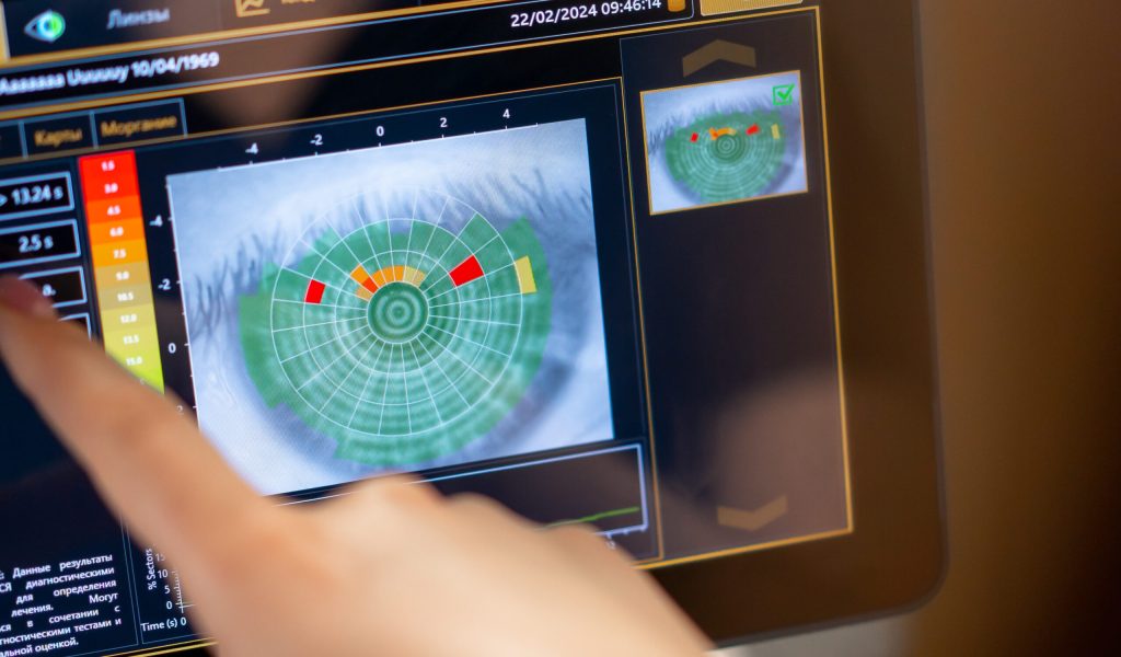 close-up of diagnostic screen with an image of the eye indicator of moisture and dry areas check